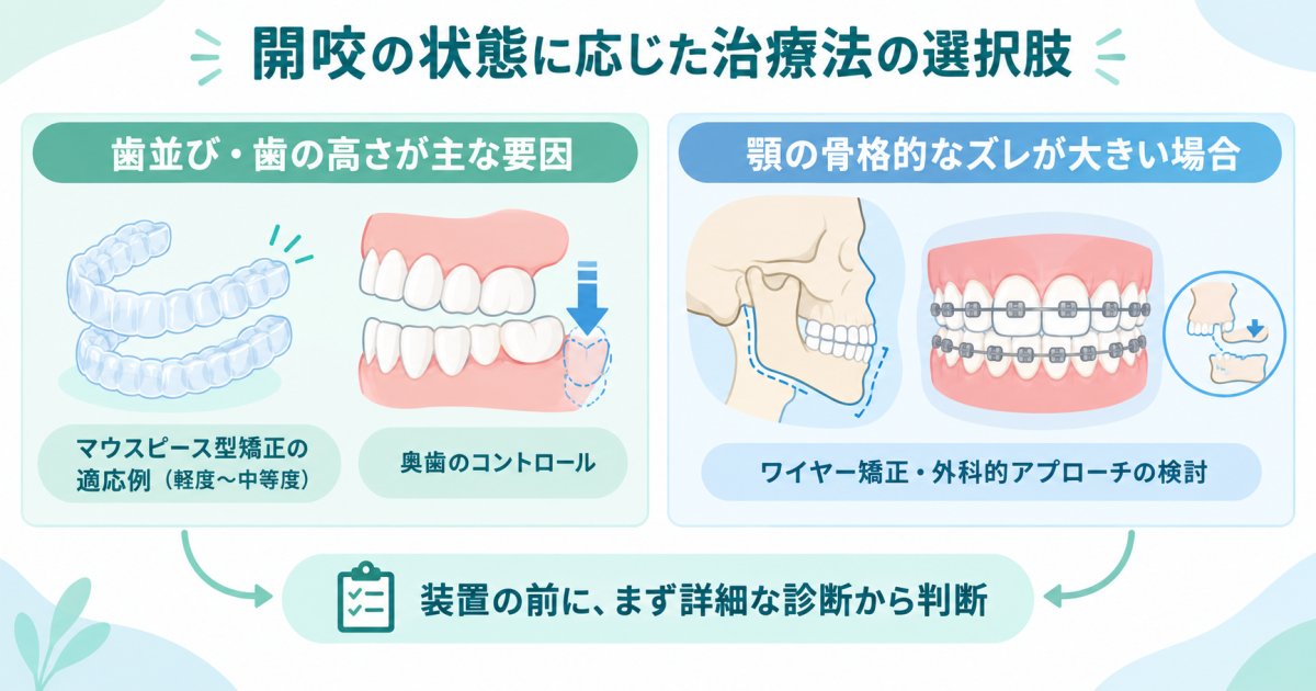 開咬はマウスピース型矯正で治せる？適応の判断基準と治療法の選択肢